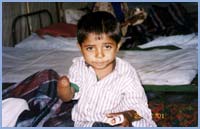 A five year old, orphaned due to the earthquake, recuperating in one of the tents after his hand was amputated