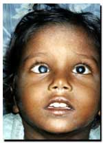 Ganesh Seth, 5 years.